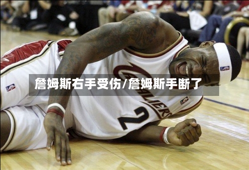 詹姆斯右手受伤/詹姆斯手断了-第1张图片