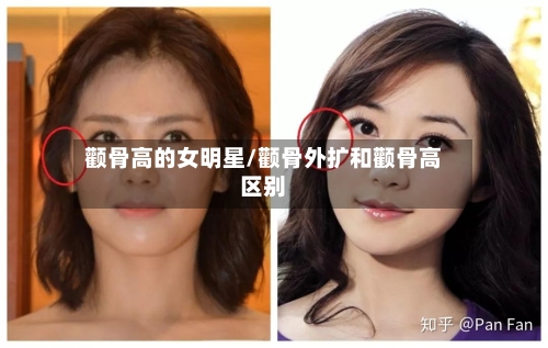 颧骨高的女明星/颧骨外扩和颧骨高区别-第1张图片