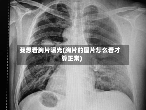 我想看胸片曝光(胸片的图片怎么看才算正常)-第1张图片