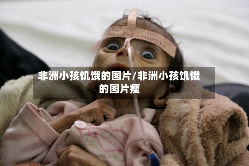 非洲小孩饥饿的图片/非洲小孩饥饿的图片瘦-第3张图片