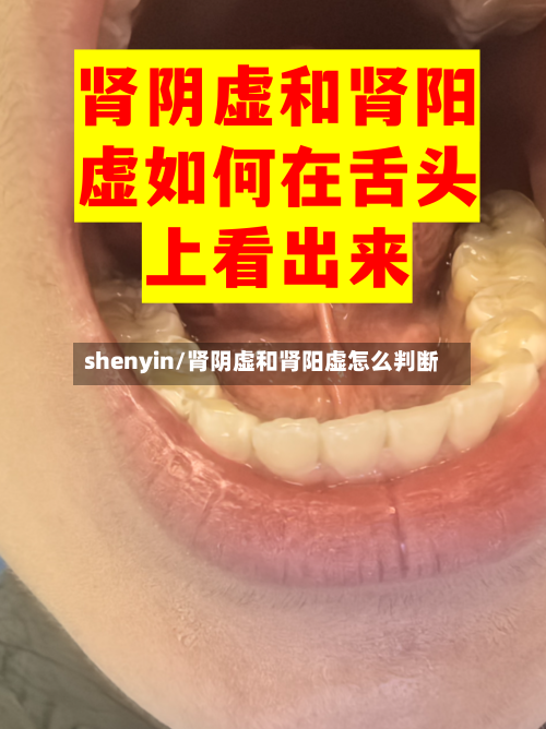 shenyin/肾阴虚和肾阳虚怎么判断-第2张图片